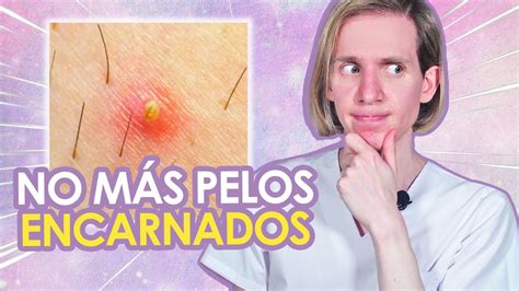 pelo encarnado en el pubis|Cómo deshacerte del vello púbico encarnado (con imágenes)